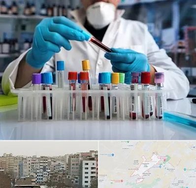 آزمایشگاه خون در محمد شهر کرج