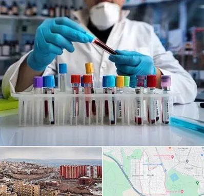 آزمایشگاه خون در سهند تبریز