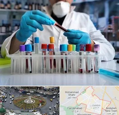 آزمایشگاه خون در فردیس کرج