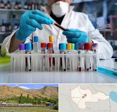 آزمایشگاه خون در خاش