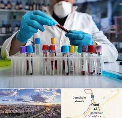 آزمایشگاه خون در قم