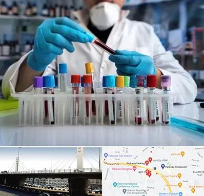 آزمایشگاه خون در پارک وی