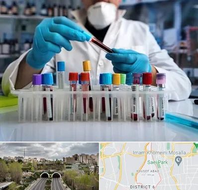 آزمایشگاه خون در یوسف آباد