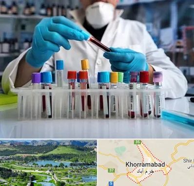 آزمایشگاه خون در خرم آباد