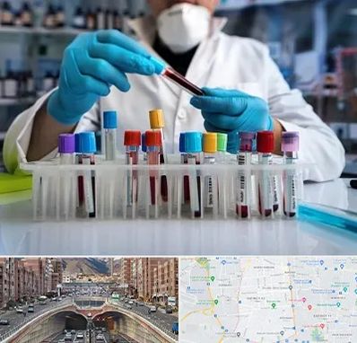 آزمایشگاه خون در منطقه 10 تهران