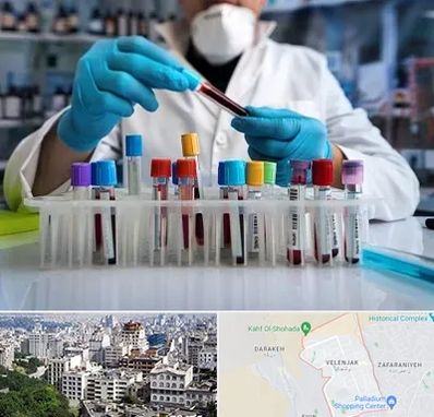 آزمایشگاه خون در ولنجک