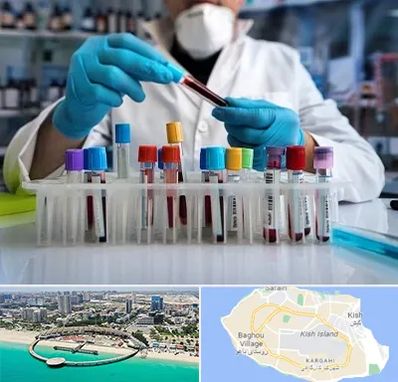 آزمایشگاه خون در کیش