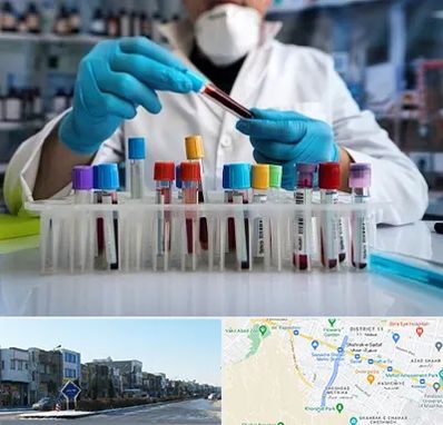 آزمایشگاه خون در شریعتی مشهد