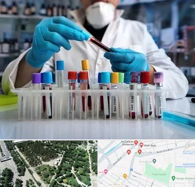 آزمایشگاه خون در سالاریه قم