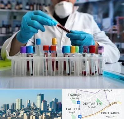 آزمایشگاه خون در قیطریه
