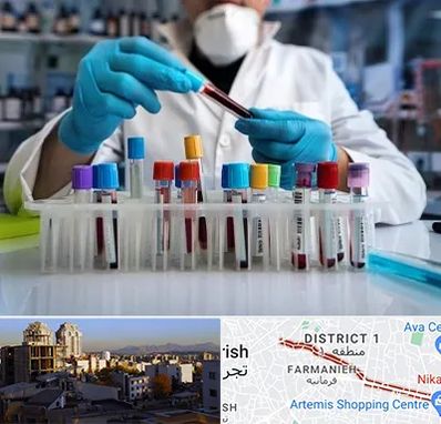 آزمایشگاه خون در فرمانیه