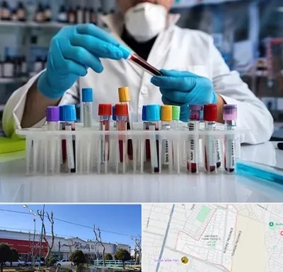 آزمایشگاه خون در فاز دو اندیشه