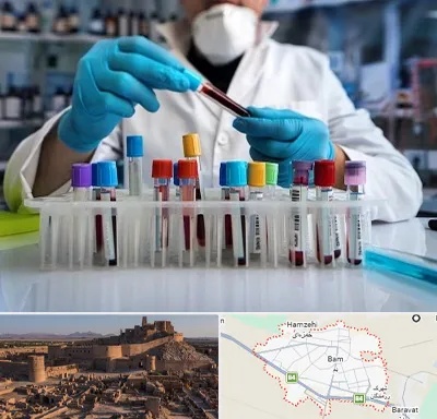 آزمایشگاه خون در بم