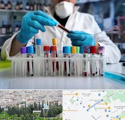 آزمایشگاه خون در محلاتی شیراز