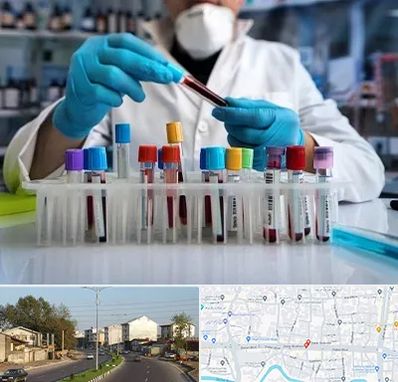 آزمایشگاه خون در ضیابری رشت
