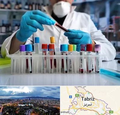 آزمایشگاه خون در تبریز
