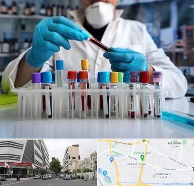آزمایشگاه خون در بلوار فردوس