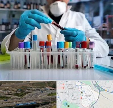 آزمایشگاه خون در یاغچیان تبریز