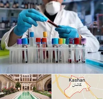 آزمایشگاه خون در کاشان