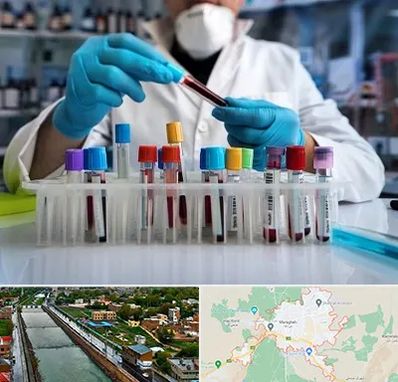 آزمایشگاه خون در مراغه