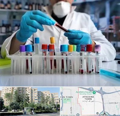آزمایشگاه خون در آپادانا