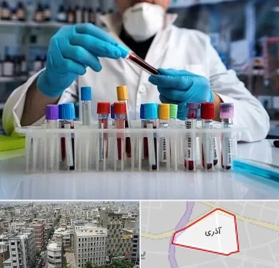 آزمایشگاه خون در آذری