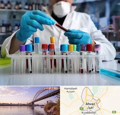 آزمایشگاه خون در اهواز