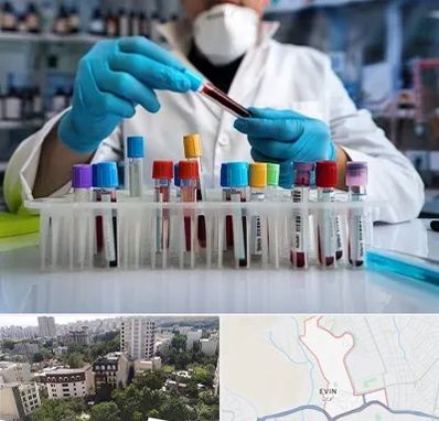 آزمایشگاه خون در اوین