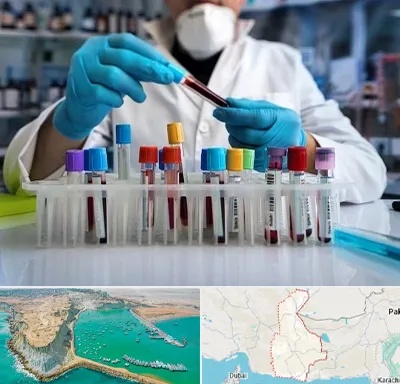 آزمایشگاه خون در سیستان و بلوچستان