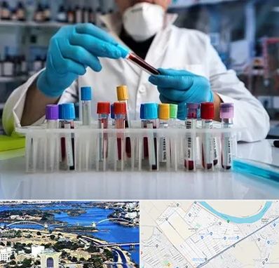 آزمایشگاه خون در کوروش اهواز