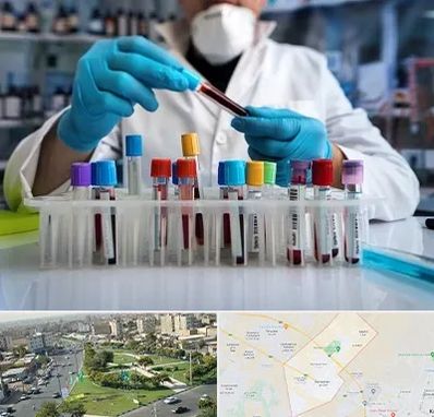 آزمایشگاه خون در کمال شهر کرج