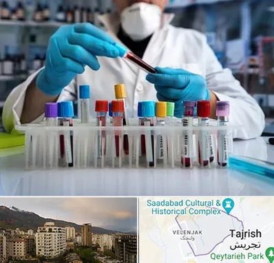 آزمایشگاه خون در زعفرانیه