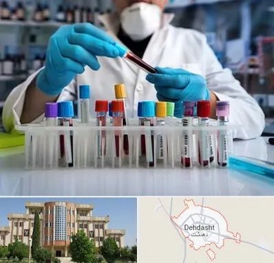 آزمایشگاه خون در دهدشت