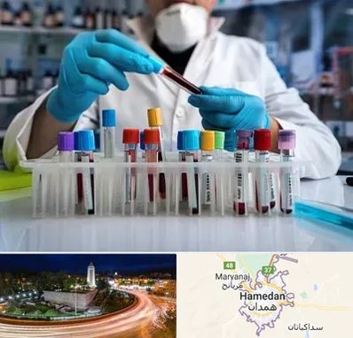 آزمایشگاه خون در همدان