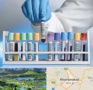 آزمایشگاه شبانه روزی در خرم آباد