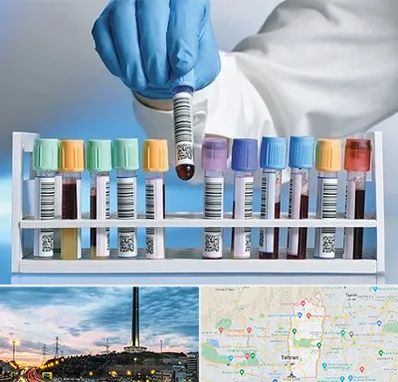 آزمایشگاه شبانه روزی در منطقه 2 تهران