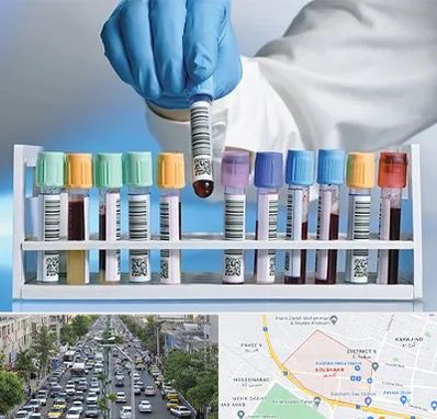 آزمایشگاه شبانه روزی در گلشهر کرج