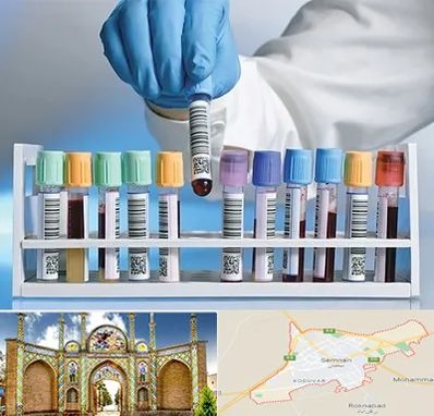 آزمایشگاه شبانه روزی در سمنان