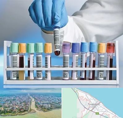 آزمایشگاه شبانه روزی در تنکابن