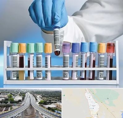 آزمایشگاه شبانه روزی در اندیمشک