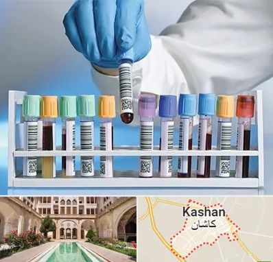 آزمایشگاه شبانه روزی در کاشان