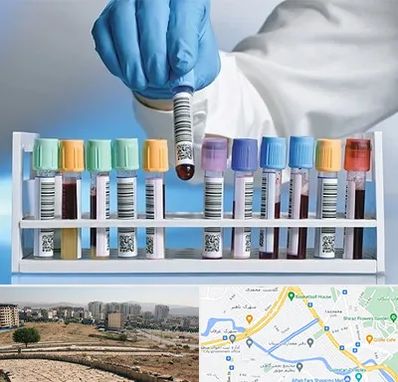 آزمایشگاه شبانه روزی در کوی وحدت شیراز