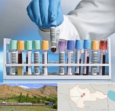 آزمایشگاه شبانه روزی در خاش