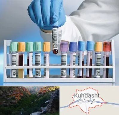 آزمایشگاه شبانه روزی در کوهدشت