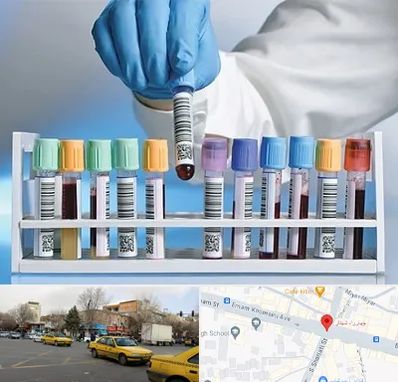 آزمایشگاه شبانه روزی در شهناز تبریز