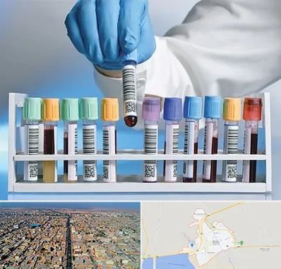 آزمایشگاه شبانه روزی در بندر ماهشهر