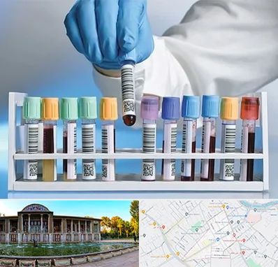 آزمایشگاه شبانه روزی در عفیف آباد شیراز