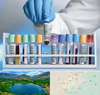 آزمایشگاه شبانه روزی در رودبار