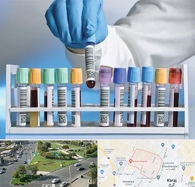 آزمایشگاه شبانه روزی در شاهین ویلا کرج