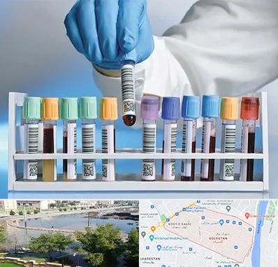 آزمایشگاه شبانه روزی در گلستان اهواز